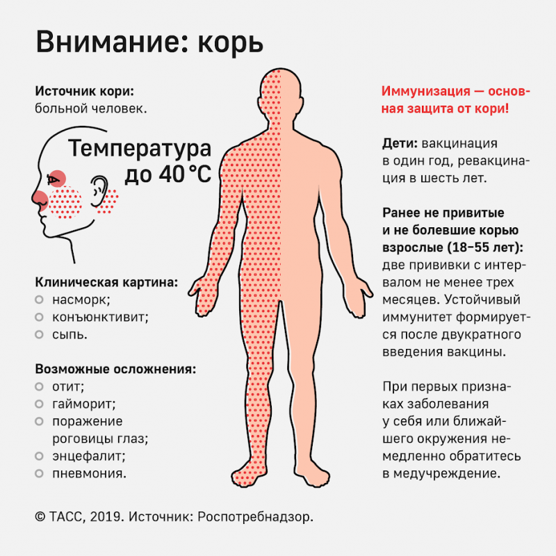 ПРОФИЛАКТИКА КОРИ